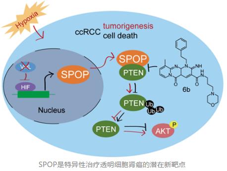 科学家发现靶标基因,肾癌研究最新突破