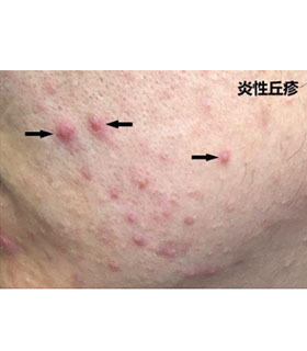 刘歪歪脱骨凤爪凉拌菜,刘歪歪的作品原声