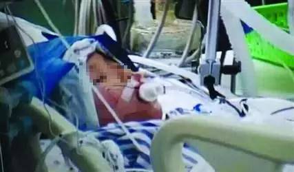 男孩咳嗽一星期被发现白肺,8个月男童反复咳嗽