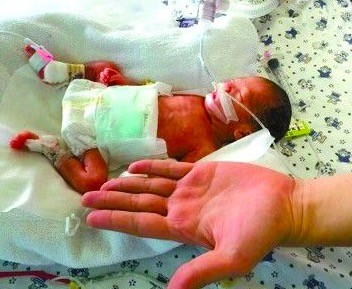 怀孕7个月的宝妈早产,早产7个月和早产8个月