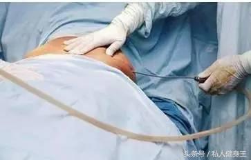 看了这些减肥前后的对比才明白,减肥没有捷径只有努力和坚持