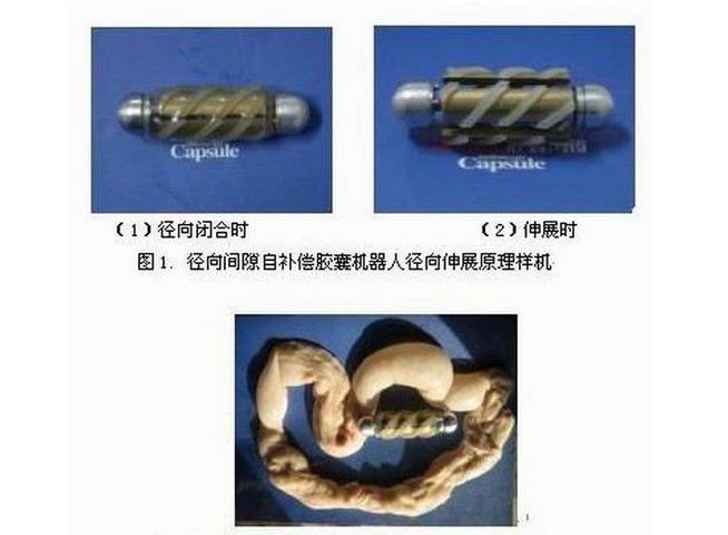 胃病患者要了解：各类胶囊机器人是如何高效无痛治胃病的