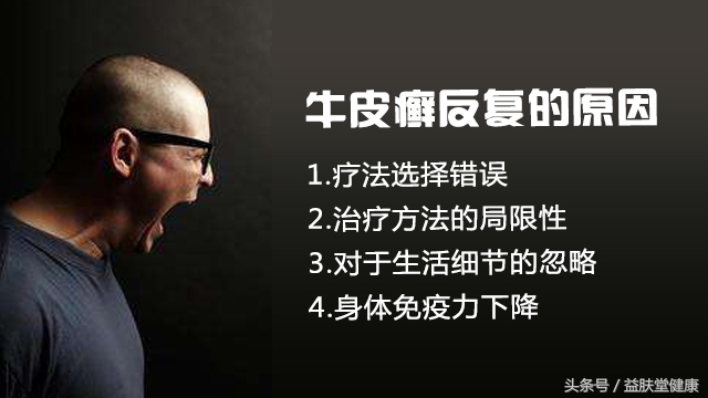 牛皮癣的病根在肝脏吗,牛皮癣病根在哪里图片