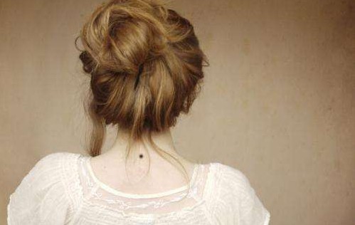 脸上肉痣可以随便切除吗,脸上的痣不能随便切吗