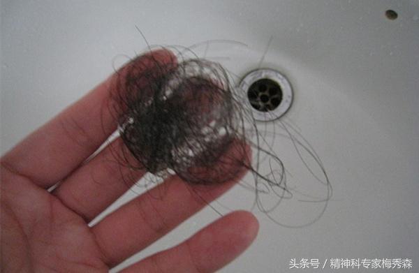 吸食*毒冰**后头发掉个不停