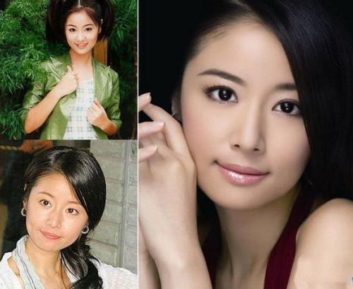 医美整形关于鼻子的知识,怎么分辨整形的鼻子