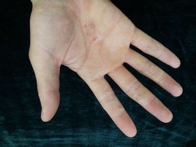 妙招解决身体大毛病