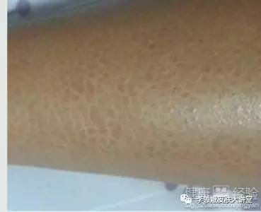 长相奇特的美人鱼,别具一格的美人鱼