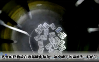 试管婴儿过程痛苦么,试管婴儿到底有多遭罪