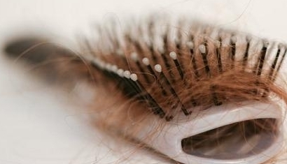 为什么最近老是掉头发呢?|年轻人脱发的七大原因