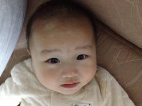 生了小孩之后得了白癜风会遗传吗,白癜风如何避免白癜风遗传给孩子