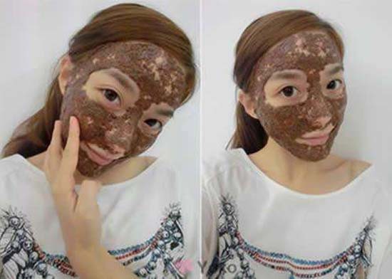 怎么祛痘印最简单实用的方法,如何祛痘印最有效简单方法