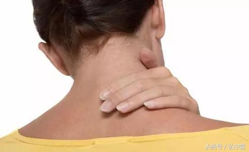 弘中堂：透皮给药治疗落枕效果明显