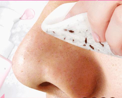 毛孔黑头的大救星,脸油干燥粗糙毛孔粗大黑头多