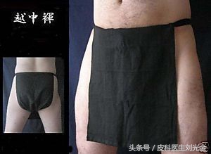 一个被外国人抢先注册的一个疾病，你知道吗？