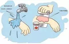 SOS！熊孩子！——儿童烧烫伤急救篇