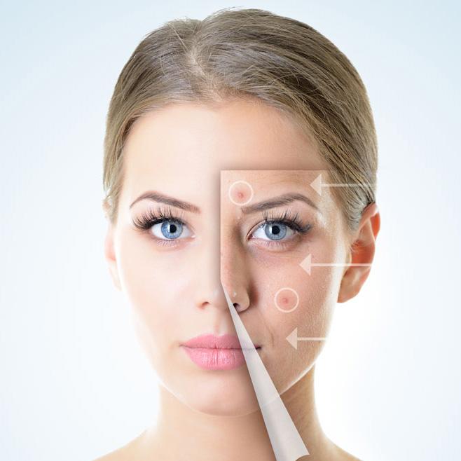 痘痘消了留下的印记怎么消,身上长痘痘留下的痘印怎么去除