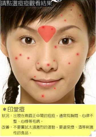 4招正确区分痘痘粉刺,粉刺是痘痘初期状态吗