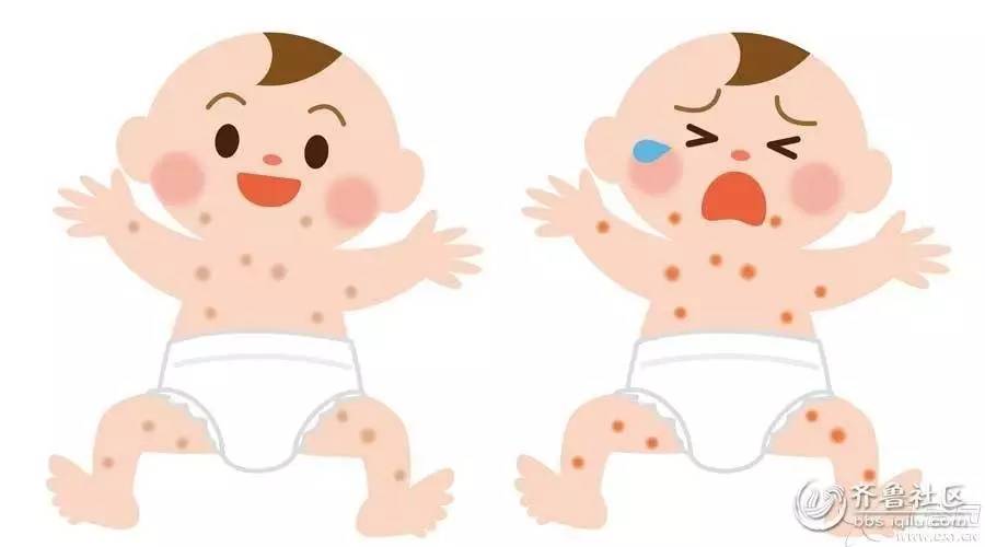 儿科过敏性紫癜个案护理范文,北京西苑治疗过敏性紫癜怎样