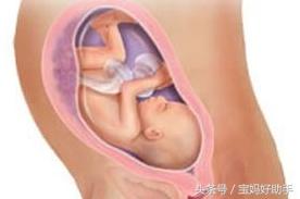 妊娠晚期需要注意什么,卵巢囊肿怀孕晚期要注意哪些问题