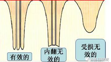 涨姿势的标准动作,涨姿势是什么