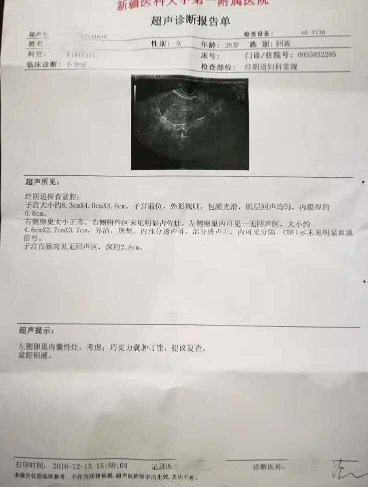 盆腔积液及巧克力囊肿治疗一则