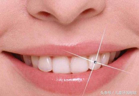 奶瓶龋特别严重怎么办,奶瓶龋齿了怎么办