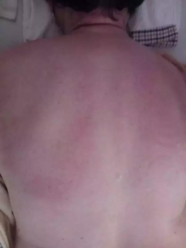 四高怎么调理才能彻底根除,四高最严重是什么表现