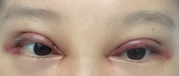 不认识的人看到我，完全看不出来做过双眼皮