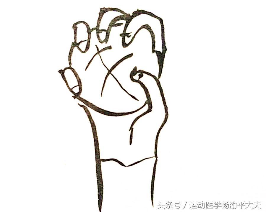 缃戠悆鑲樻湁鏁堢殑搴峰鍔炴硶,缃戠悆鑲樻湁鏁堢殑搴峰鏂规硶