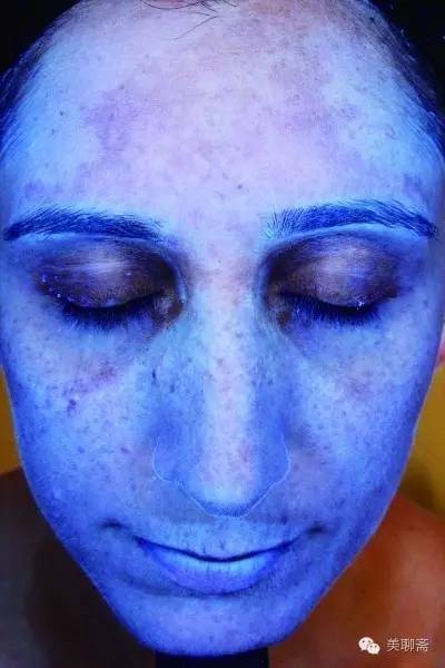 有防晒指数的粉底可以代替抹防晒霜吗？为什么防晒还是晒黑了呢？关于防晒的一切都在这里了