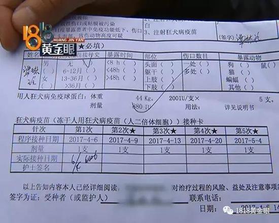 女子保护4岁女孩被斗牛犬咬伤,女子被斗牛犬咬伤