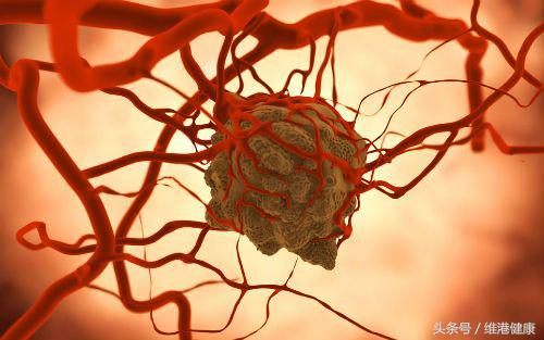 pd1治愈了黑色素瘤,pd1治疗黑色素的效果