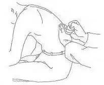 腹痛的辨证范畴,腹痛鉴别