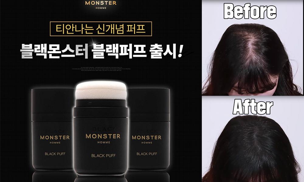 为什么没人敢去植发,为什么很多人都没有去植发