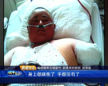 19岁小伙被邻居用利器伤后后续,农村小伙正在干农活突然意外发生
