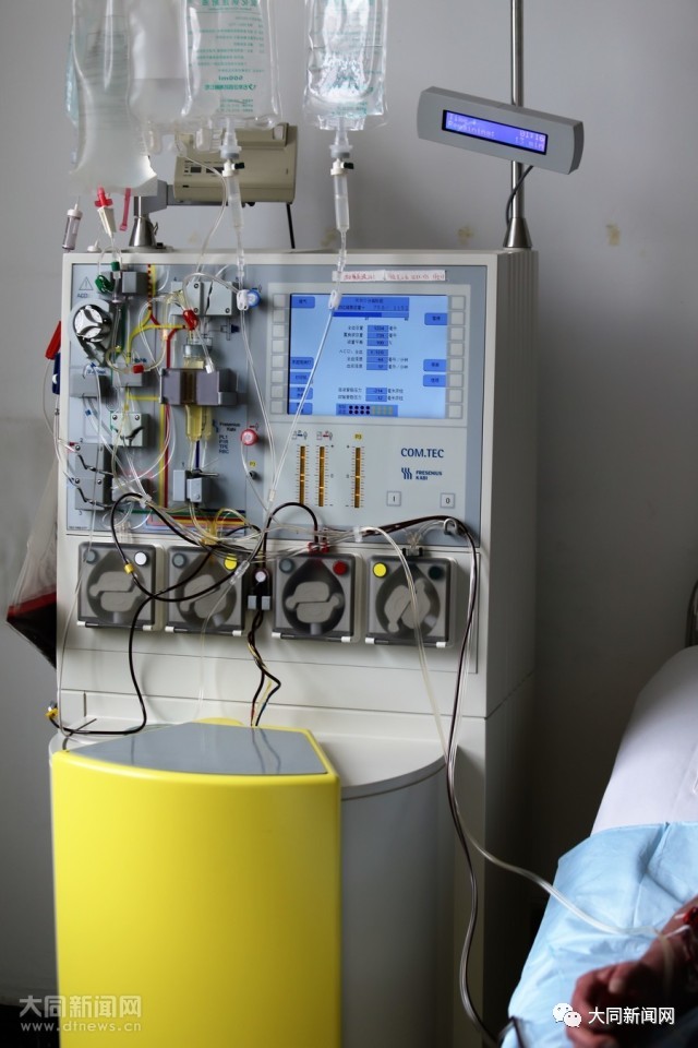 厉害！30分钟解除了同煤许大爷半生的痛！这一招很多人不知道……