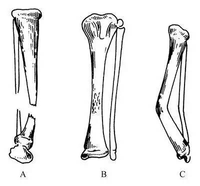 罕见病儿童时期发病,究竟罕见病孩子应该治疗还是放弃
