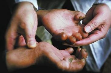 人类历史瘟疫记录,人类瘟疫灾难史