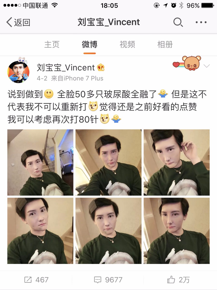 井柏然撞脸金城武，“僵硬”神器玻尿酸这次反而救了人？