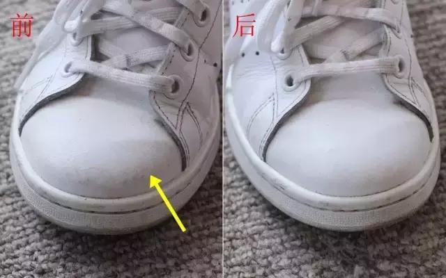 小白鞋清洁去污净怎样使用,小白鞋变黄了变脏了怎么刷白妙招
