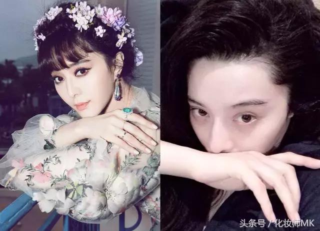 真实贴双眼皮贴,单眼皮怎么贴第二天变双眼皮