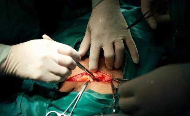 顺产第一天后睡姿和注意事项,顺产有关知识