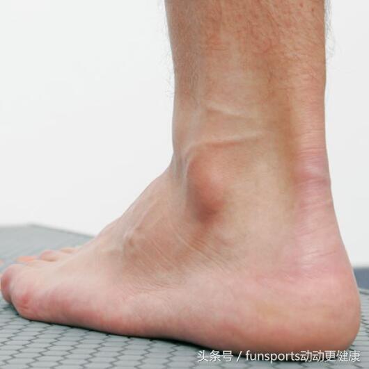 足球运动员跟腱长短重要吗,足球运动员跟腱长好不好