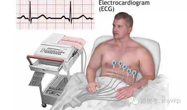 这项最便宜的检查,你做了吗?