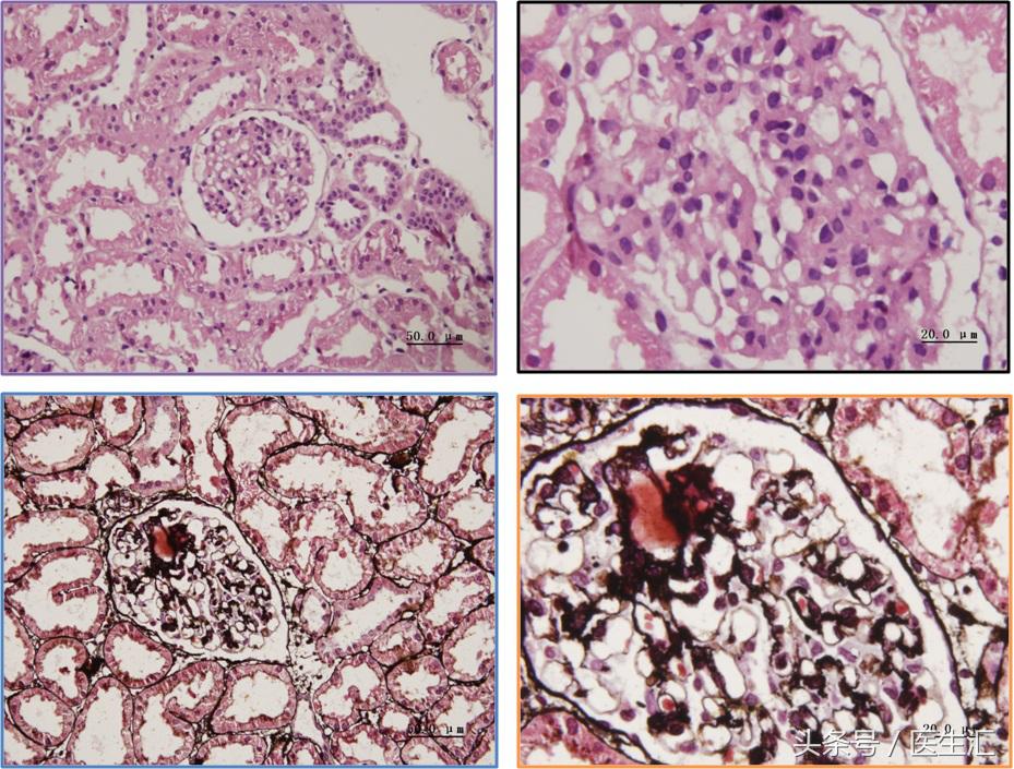 神经内科疾病诊断公式,神经系统疾病的诊断思路及步骤