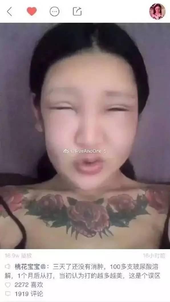 一眼就秒杀刘梓晨的“鱼精女”，看她整容后的脸感觉今晚会做噩梦