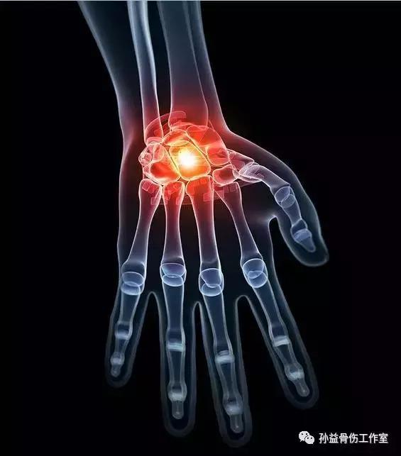 腕关节和手指疼痛是什么原因,腕关节很难受怎么办