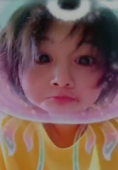 郑爽压力大深夜失眠嘴角上火，头发凌乱还不忘卖萌放飞自我！