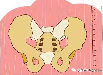 40周胎儿为何迟迟不入盆,胎儿足月迟迟不入盆